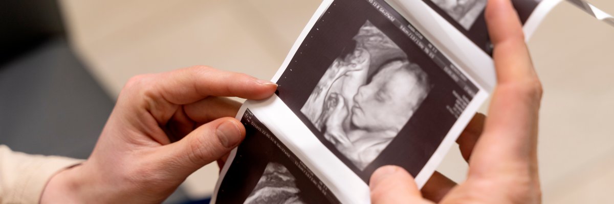 Ultrasound image
